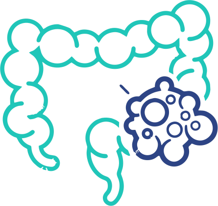Duodenal & Small Intestine Cancers