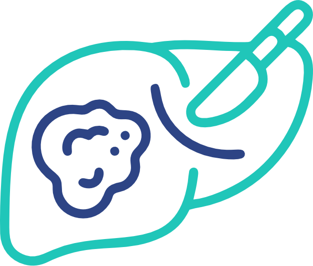 Liver Abscess (Liver Infection)